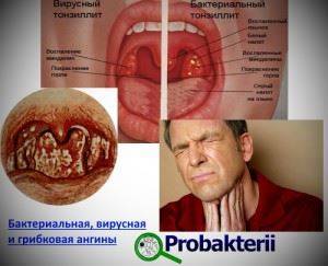 Значение болезнетворных бактерий