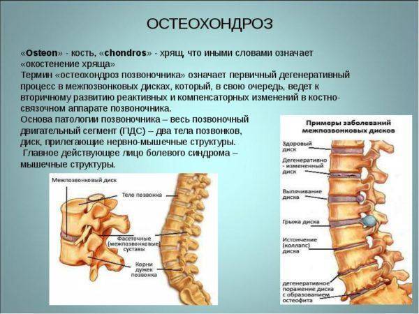 Как лечить грыжи и протрузии позвоночника?