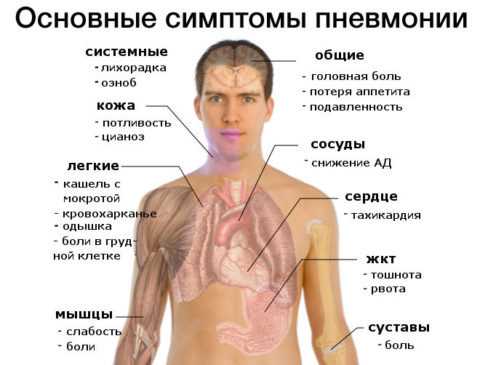 Особенности пневмонии у пожилых людей. какие виды болезни опаснее для лежачих стариков?