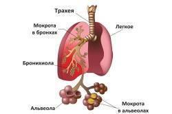 Кашель с прожилками крови