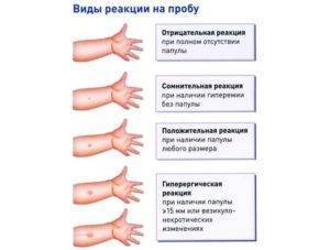 Подскажите