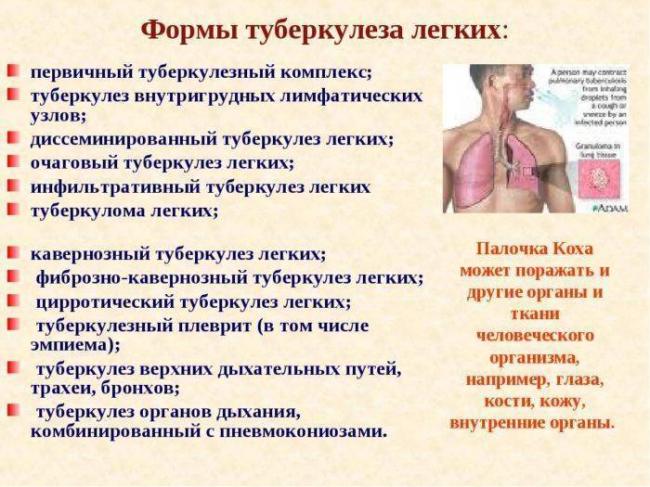 Какая мокрота при туберкулезе, или как вовремя диагностировать заболевание?