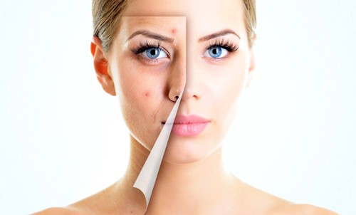 Ретиноевая мазь (retinoic ointment)