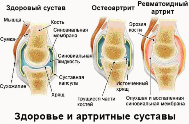 Мазь живокоста: инструкция, отзывы и аналоги
