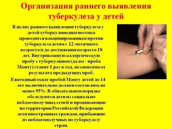 Туберкулезная палочка у детей