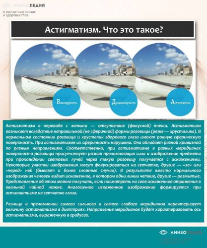 Астигматизм: как правильно подобрать очки?
