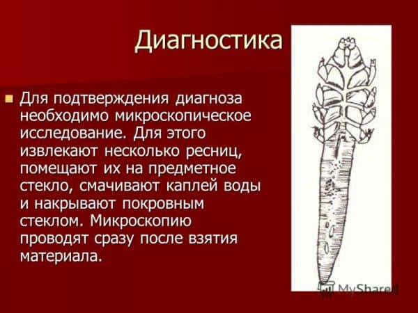 Демодекоз у человека на ресницах