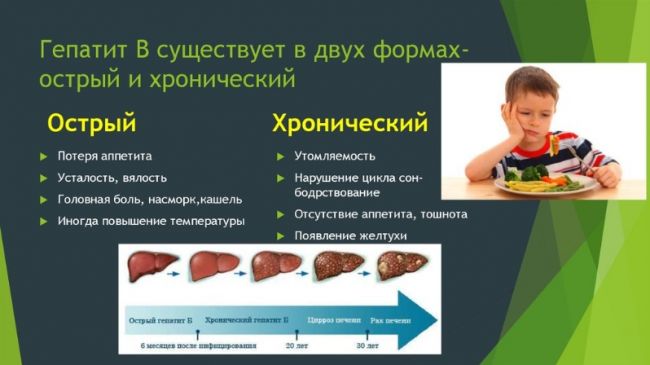 Вирусный гепатит а