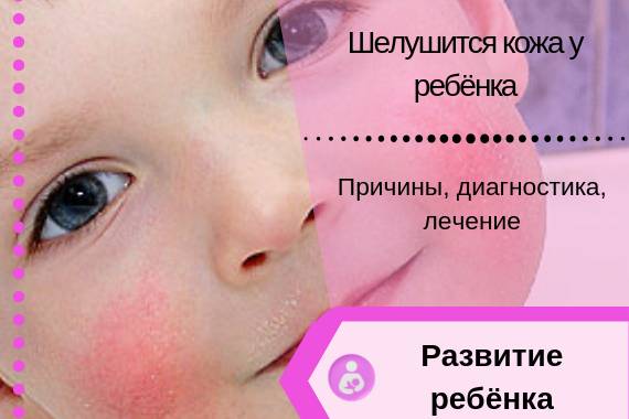 Шелушится кожа у новорожденного на теле, руках и ногах, на голове: что делать