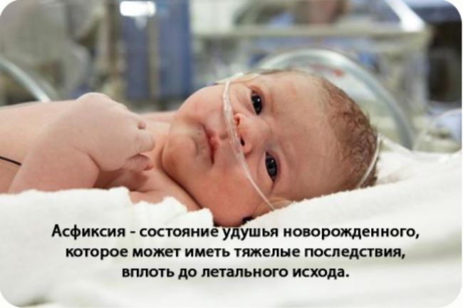 Лечение и симптомы внутричерепного давления у детей, грудничков. как измерить, признаки вчд
