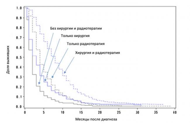 Глиобластома головного мозга у детей: причины, симптомы, лечение