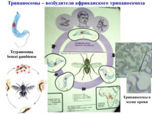 Сонная болезнь