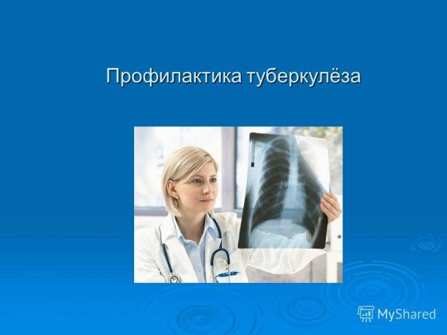 Как лечится туберкулёз лёгких у взрослых