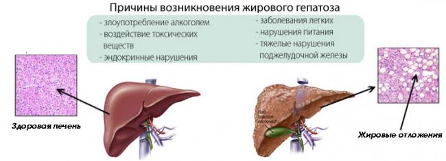 Липотропный фактор эвалар отзывы