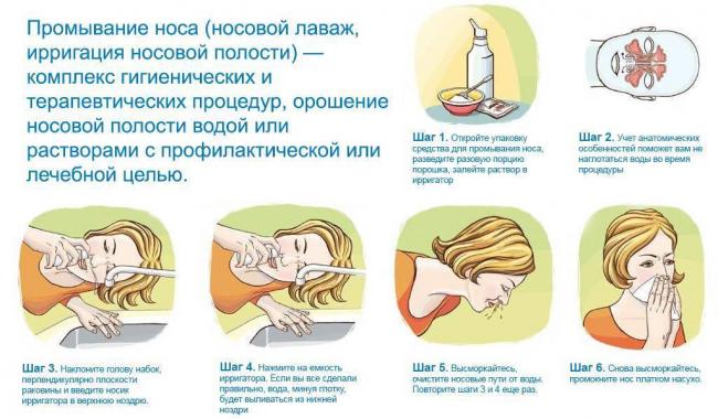 Применение Диоксидина для ингаляций небулайзером