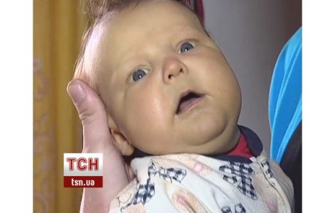 Порок сердца у новорожденных