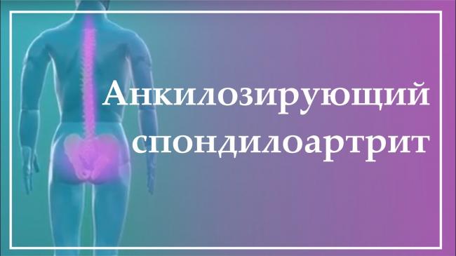 Болезнь бехтерева