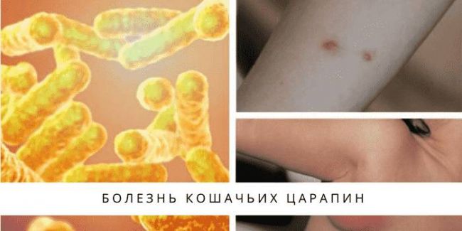 Как распознать болезнь кошачьих царапин, лечение