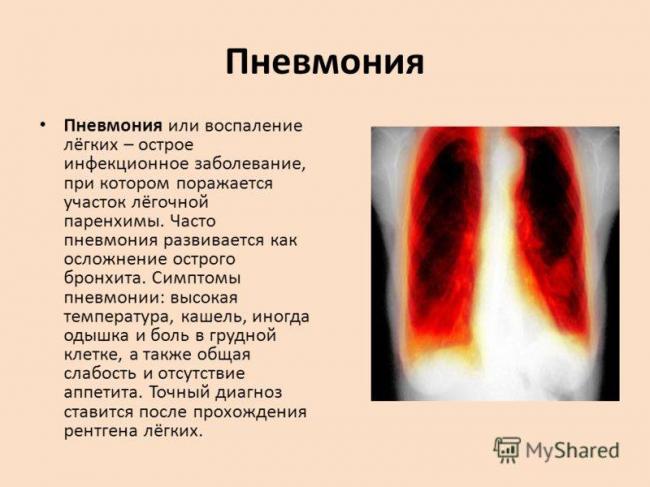 Характеристика анализа крови у ребенка при пневмонии