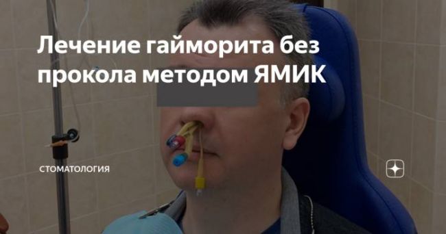 Как вылечить гайморит без прокола. что поможет побороть недуг