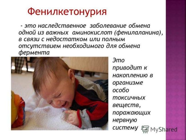 Наследственные болезни обмена аминокислот (фку, алкаптонурия, альбинизм и др.)