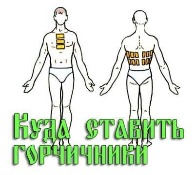 Горчичники при кашле детям и взрослым