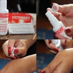Клотримазол для ушей инструкция по применению цена