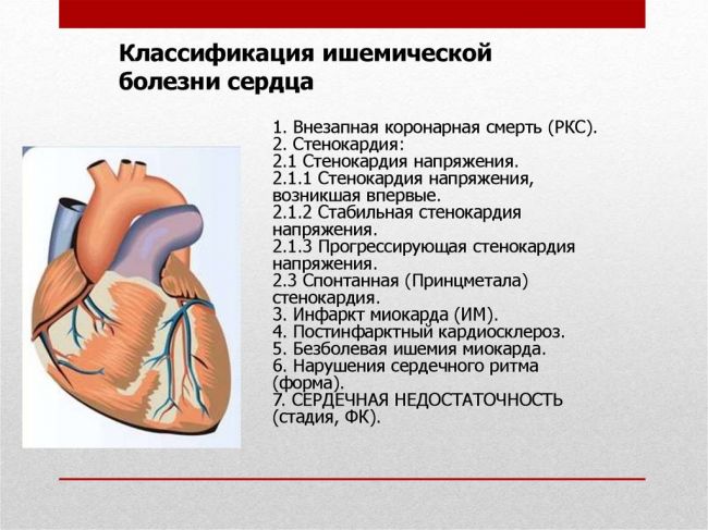 Что такое постинфарктный кардиосклероз, причины и симптомы, лечение и потенциально смертельные последствия