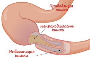 Меню после операции на кишечнике онкология меню