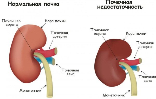 Нимулид гель: инструкция по применению, цена, отзывы и дешевые аналоги