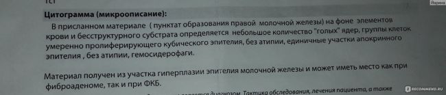 Фиброаденома молочной железы