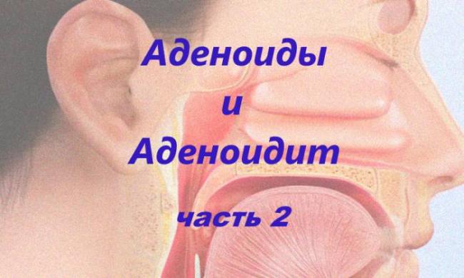 Аденоидит: причины, формы и степени, симптомы, тактика лечения