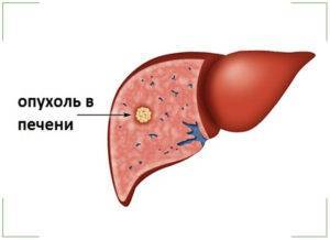 На белках глаз красные прожилки
