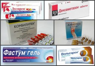 Защемление нерва в спине: что делать, если защемило, симптомы, как лечить