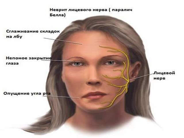 Мурашки по голове, телу, ногах, руках, лице. причины у женщин, лечение