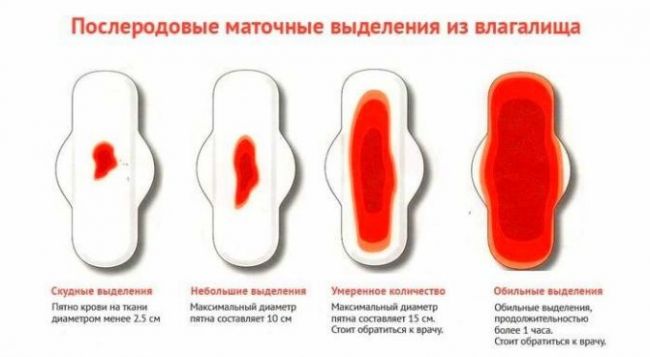 По следам... выделения после родов. кровянистые выделения после родов и кесарева сечения