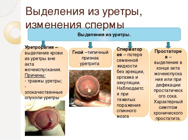 Прозрачные выделения у мужчин