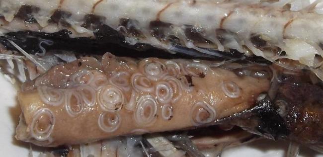 Какие продукты опасны для глистов
