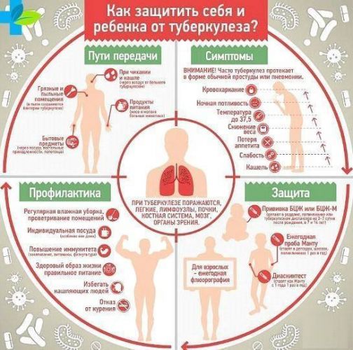 Симптомы туберкулеза легких у взрослых, диагностика и принципы лечения