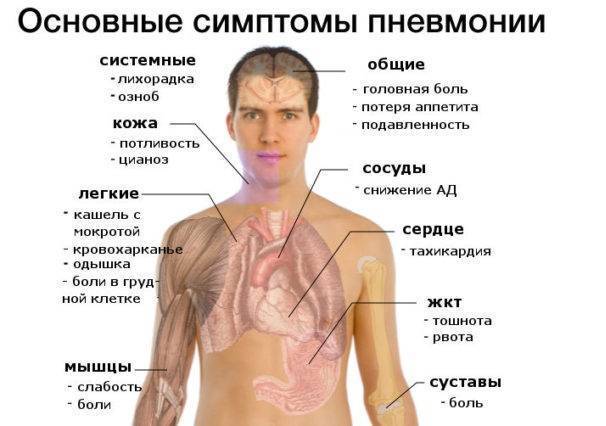 Признаки воспаления легких у взрослого