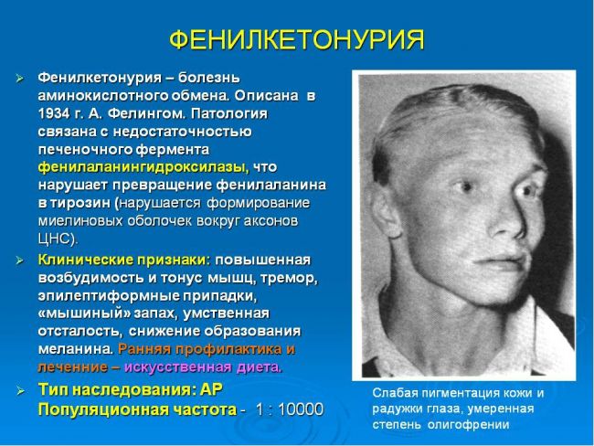 Фенилкетонурия (фку). причины, симптомы, диагностика и лечение фенилкетонурии. лечение фенилкетонурии: диета и питание. :: polismed.com