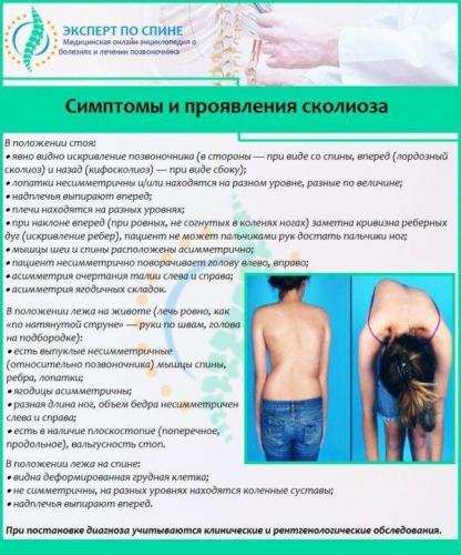 Какой врач лечит сколиоз (искривление позвоночника)