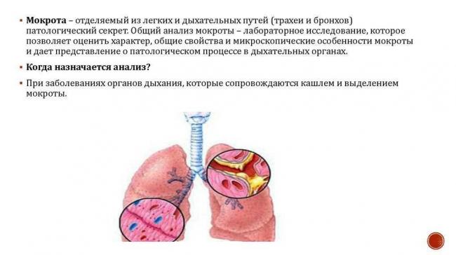 Мокрота при туберкулезе: цвет, состав, консистенция, заразна ли?