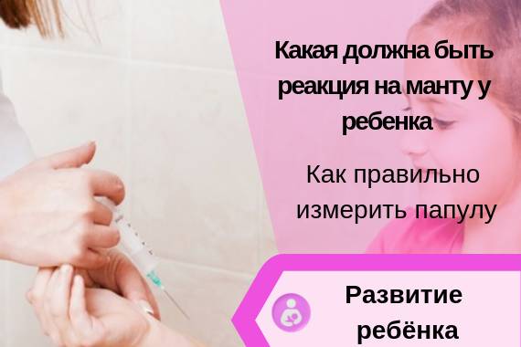Сомнительная реакция манту что значит: заражение или случайность?