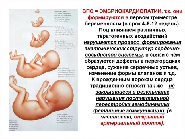 Порок сердца: причины, разновидности, симптомы, диагностика, лечение, прогноз и профилактика. консультации специалистов