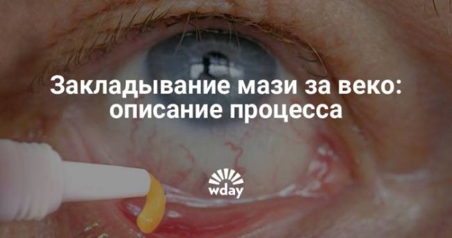 Тетрациклиновая мазь для глаз при конъюнктивите, ячмене у детей, женщин при беременности. инструкция по применению