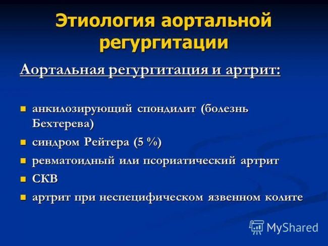 Трикуспидальная регургитация 1-4 степени: причины и симптомы, лечение и прогноз жизни