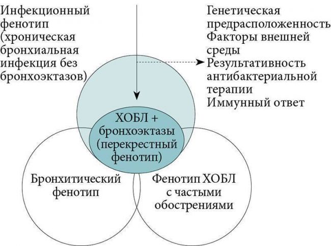 Последняя стадия хобл. лечение, уход и перспективы
