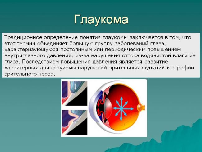Повышенное внутриглазное давление симптомы у взрослых