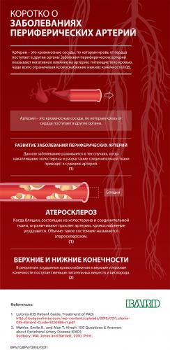 Бляшка в сонной артерии